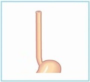 イラスト(食道)