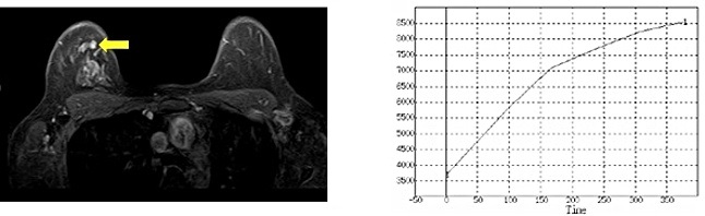 �ǐ��̓��BMRI�摜�Ǝ��ԐM���Ȑ�