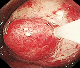 �q�{��ǃ|���[�v